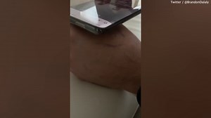 Computer chip implanted in man's hand glows green under his skin to scan phone