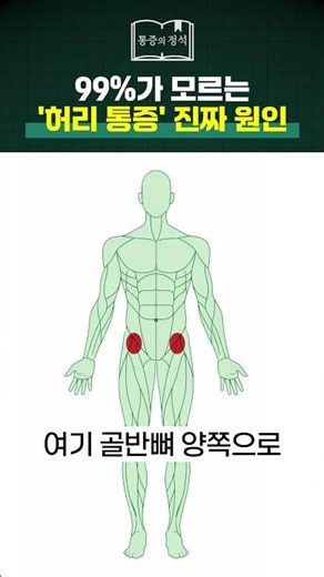 The Real Cause of Back Pain 99% of People Don't Know | Back Pain, Spinal Stenosis, Thread Embeddi...