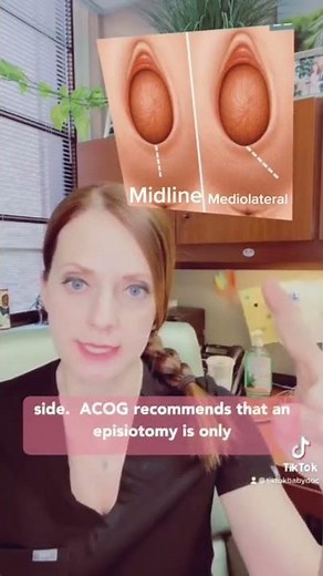 What is an episiotomy? #episiotomy #birth #childbirth #laboranddelivery #obstetricallacerations