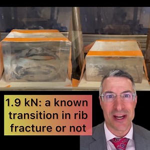 Breast implants and car accidents