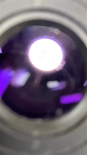 20K views · 341 reactions | Stool sample  #lablife #microbiology | Lab life | Facebook