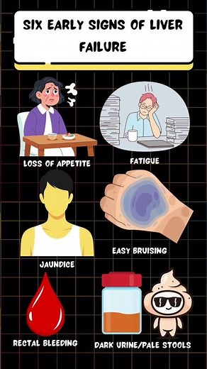 Early signs of liver failure