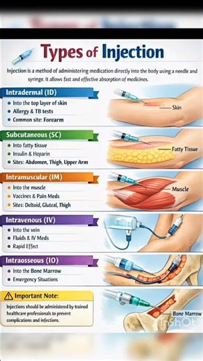 Types of injection # single shot # important # study motivation