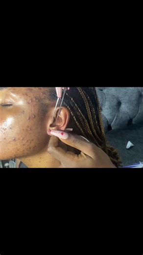 Intense ASMR Ear Cleaning and Scalp Massage for Sleep