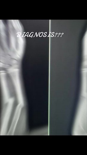 what is the Diagnosis??? #Interventional #Radiological #Technologist #RADIOLOGY #students #XRAY @Dr Sahibzada Imtiaz Ahmad @Sayed Nizam Jan Termize @DrGhazanfar52