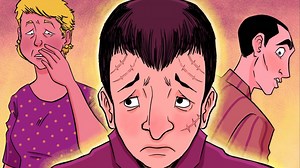 2.6M views · 80K reactions | People Avoid Me Because Of My Face | Minutevideos | Facebook