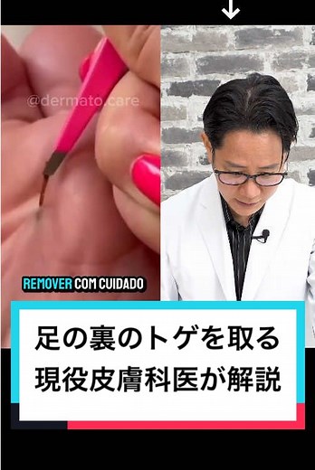 足裏のトゲの取り方を皮膚科医が解説
