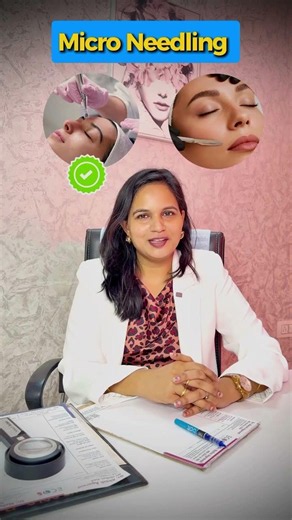Which Skin Treatment Is Best? 🤔 Dermatologist Reveals the Right Choice for Your Skin