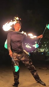 8.5K views · 239 reactions | Part 2 of a multistaff contact burn at...