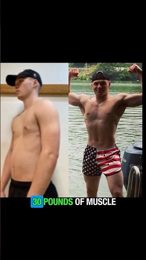 Pectus Excavatum Transformation (NO SURGERY!)