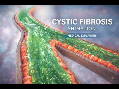 Cystic Fibrosis Animation | Medical Explainer