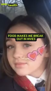 I Needed A Feeding Tube In School ‘My body thinks food is poison.’ Aimee was born with a rare allergy condition where her esophagus becomes inflamed and doesn't contract properly. She shares how this impacted her life growing up and how she rebuilt her confidence after having a feeding tube. | seen.tv