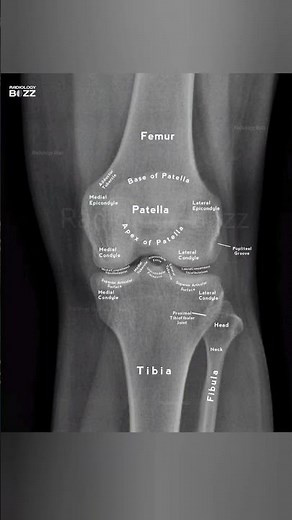 🦴✨ Exploring the Knee Joint Anatomy through an X-ray! #medicalimaging #anatomy #radiologybuzz