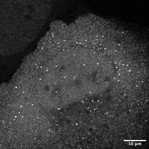We have developed a cysteine-free, highly thermostable tagging system, UTag, that enables single-mRNA translation tracking in live cells. You may wonder how different tagging systems affect translation kinetics—we addressed this by performing a systematic comparison.