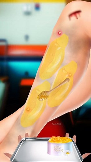 Legs Wax boils acne Treatment Clean Satisfying ASMR #waxing #care #satisfying #legs #reelsfypシ Tunnig ASMR | Tunnig ASMR