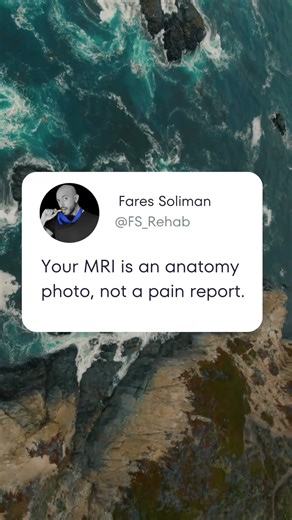 Can an MRI predict pain?