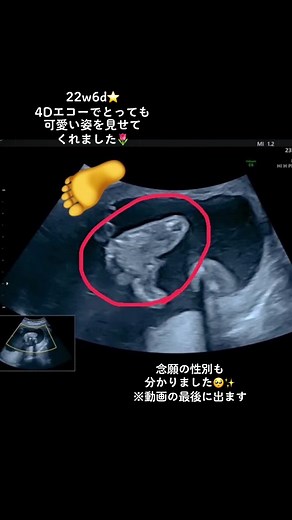 22週でやっと性別判明！4Dエコーで我が子が可愛すぎる🥺💓