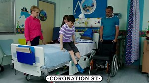Why did Jack Webster have his leg amputated on Coronation Street and how did he get sepsis?