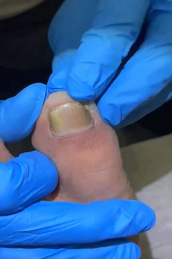 Getting a pedicure done! 💅✨ Treat yourself to some self-care! #PamperYourself #SelfCareGoals | Michelle Cummings