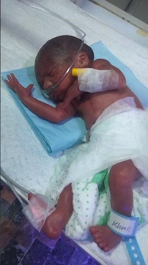 Extremely Low Birth Weight (ELBW) Baby in NICU |Tiny fighter #ExtremelyLowBirthWeight #NICU #Preemie