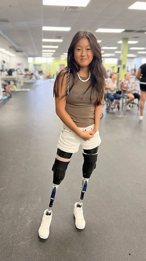 It’s that time again! Our awesome POA kiddos are getting ready for another school year! Here are just a few of the kids we have seen in the past week or so. 📚🚌🦿 #poaorlando #prosthetics #amputee #backtoschool #leg #monday | Prosthetic & Orthotic Associates (POA)