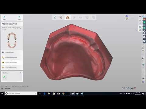 [Webinar] 3D Printing Digital Dentures with Dentca Resins – Part 2 with Cory Lambertson