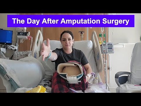 Below the Knee Amputation: What It’s Really Like the First Day after Amputation
