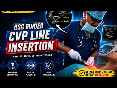 USG guided Cvp line insertion procedure|Real time|Precise placement|Safer patient care|Subscribe|…..