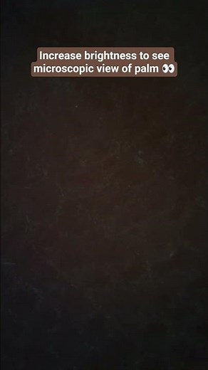 Microscopic view of hand 🔬