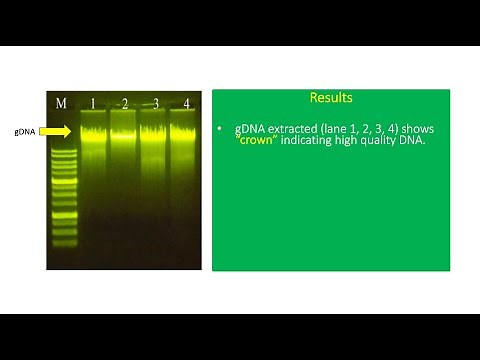 How To Interpret Extracted DNA Result In Agarose Gel 🧬