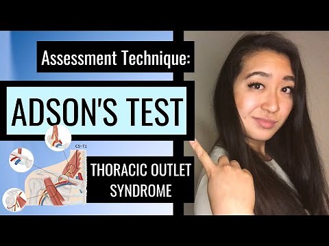 Adson's Test (THORACIC OUTLET - PT ASSESSMENT)