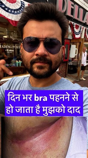 DR ANIMESH GUPTA on Instagram: "For candidal intertrigo(fungal infection), use SURZOLE CREAM 2 times daily for 15 days. Available on SURGERYONLINE APP. Disclaimer: You can upload photo of your skin condition and get FREE prescription on SURGERYONLINE APP. Take prescriptions before using it."