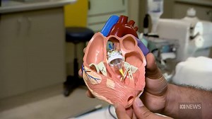 Dr Nikhil Pal explains the TAVI procedure