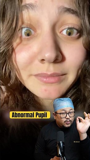 Key Hole Pupil | Dr Explains...