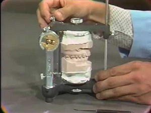 Occlusal Adjustment of Mounted Cast