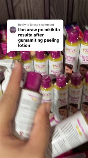 SCD Peeling Lotion Review: Discover Its Benefits