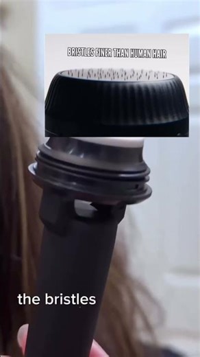 Getting rid of acne scars without pain. One session takes 10 minutes #acnescars #microneedling