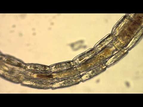 Chironomidae - A Midge Larvae