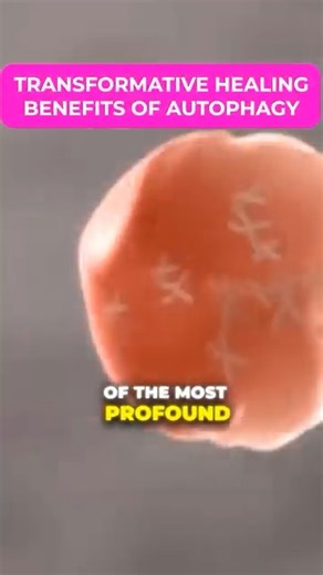 Autophagy is an incredible healing process that should be used by everyone as a way to improve your health. Dr. Thomas Seyfried suggests that 2 seven days fasts per year or multiple 3-4 day fasts is enough to help an individual completely avoid cancer. Fasting induced autophagy is an incredible way to promote amazing health and prevent the chronic disease epidemic so many of us are plagued by. Stay Healthy! Dr. Z #drnickzyrowski #naturalhealing #nuvisionhealthcenter #NaturalSupplements #fasting 