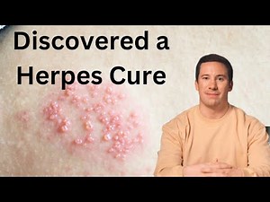 Discovered a Herpes Cure That Will Change Everything