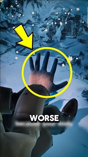 If you ever get frostbite… this is what happens
