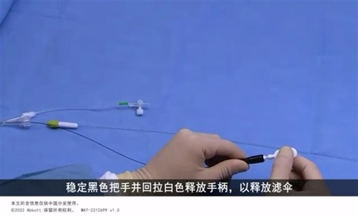 Emboshield NAV6抗栓塞远端保护装置