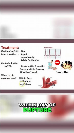 2-Minute How tPA is Used to Treat Ischemic Stroke? #shorts