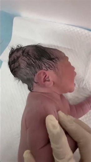 New Born Baby Head Lammba 😱 #baby #adoreble #newborncare #cutebaby #adorably #newborncrying #shorts