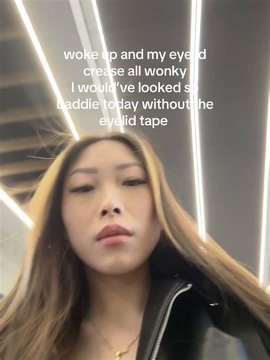 Eyelid Crease Issues: Taming Wonky Eyelids