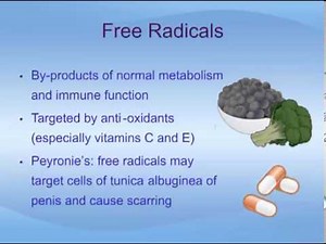 Understanding Peyronie's Disease