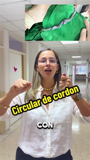 La circular de cordón, o nucal, es cuando el cordón umbilical se envuelve alrededor del cuello del feto, siendo una situación común (19-24% de embarazos) que raramente complica el parto. Generalmente, no obstruye el flujo de oxígeno ni requiere cesárea, ya que el bebé recibe nutrientes por la sangre, no por la respiración pulmonar #cordon #bebe #poder