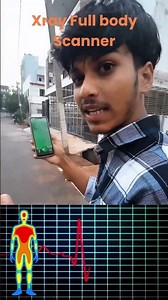 Amazing Xray Camera Body Scanner | HD Body Scanner App | 14