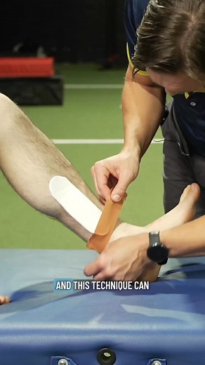 🩹 Here is a tape job that you can use to help manage pain for your medial tibial stress syndrome (MTSS) patients.⁠ ⁠ 💡 It's essential to rule out a bone stress injury in these cases and @brad_beer teaches how to do this in this Practical.⁠ ⁠ 🤔 Want to learn more?⁠ ⁠ 🔥 Check out our Practical, Management of Running Injuries with Brad Beer, with a 7-day FREE trial https://www.physio-network.com/practicals/ | Rethinking Physiotherapy