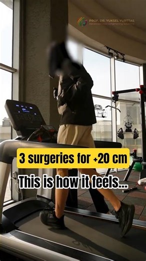 ​This is how it feels to be 20 cm taller after 3 limb lengthening surgeries